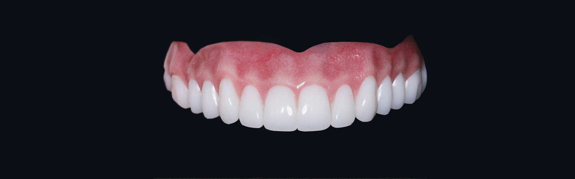 Dentures and Partials