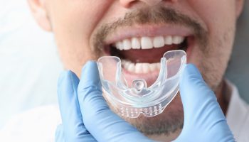 10 Signs You May Need Nightguards for Teeth Protection